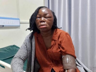 Woman in Bungoma,Marystella Kongani hospitalized in critical condition after being assaulted by her lover